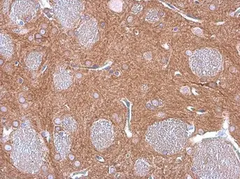 Anti-GEF-H1 antibody [GT1132] used in IHC (Paraffin sections) (IHC-P). GTX629399