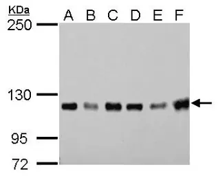 Anti-GEF-H1 antibody [GT1132] used in Western Blot (WB). GTX629399