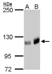 Anti-GEF-H1 antibody [GT1132] used in Western Blot (WB). GTX629399