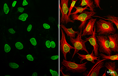 Anti-Lamin A + C antibody [GT9712] used in Immunocytochemistry/ Immunofluorescence (ICC/IF). GTX629404