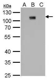Anti-Dengue virus NS5 protein antibody [GT353] used in Western Blot (WB). GTX629446