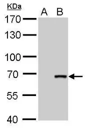 Anti-Cre recombinase antibody [GT10212] used in Western Blot (WB). GTX629479