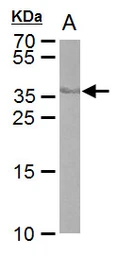 Anti-Cre recombinase antibody [GT10212] used in Western Blot (WB). GTX629479
