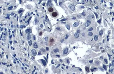 Anti-p21 Cip1 antibody [GT1032] used in IHC (Paraffin sections) (IHC-P). GTX629543