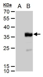 Anti-DDDDK tag antibody [GT231] used in Western Blot (WB). GTX629631