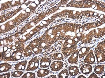Anti-E-Cadherin antibody [GT477] used in IHC (Paraffin sections) (IHC-P). GTX629691