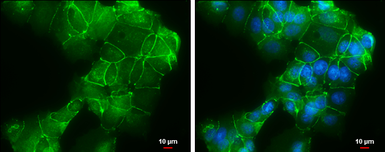Anti-E-Cadherin antibody [GT477] used in Immunocytochemistry/ Immunofluorescence (ICC/IF). GTX629691