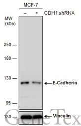Anti-E-Cadherin antibody [GT477] used in Western Blot (WB). GTX629691
