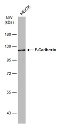 Anti-E-Cadherin antibody [GT477] used in Western Blot (WB). GTX629691