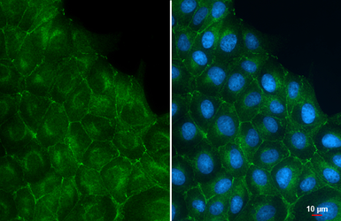 Anti-E-Cadherin antibody [GT477] used in Immunocytochemistry/ Immunofluorescence (ICC/IF). GTX629691
