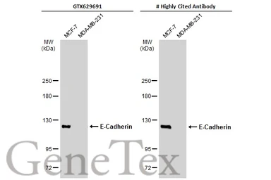 Anti-E-Cadherin antibody [GT477] used in Western Blot (WB). GTX629691