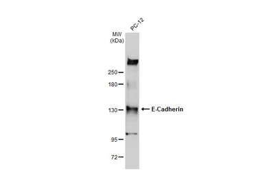 Anti-E-Cadherin antibody [GT477] used in Western Blot (WB). GTX629691