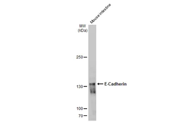 Anti-E-Cadherin antibody [GT477] used in Western Blot (WB). GTX629691