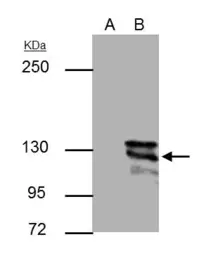 Anti-E-Cadherin antibody [GT477] used in Immunoprecipitation (IP). GTX629691