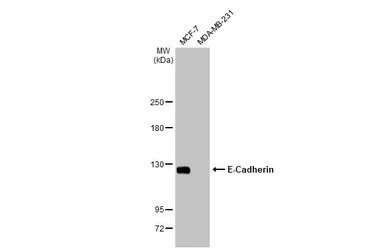 Anti-E-Cadherin antibody [GT477] used in Western Blot (WB). GTX629691