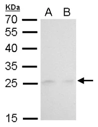 Anti-MAD2L1 antibody [GT1761] used in Western Blot (WB). GTX629697