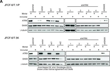Anti-ATRX antibody [GT4212] used in Western Blot (WB). GTX629703