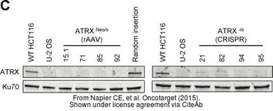 Anti-ATRX antibody [GT4212] used in Western Blot (WB). GTX629703