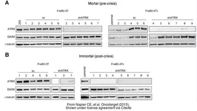 Anti-ATRX antibody [GT4212] used in Western Blot (WB). GTX629703