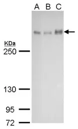 Anti-ATRX antibody [GT4212] used in Western Blot (WB). GTX629703