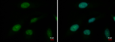 Anti-ATRX antibody [GT4212] used in Immunocytochemistry/ Immunofluorescence (ICC/IF). GTX629703