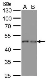 Anti-gamma Tubulin antibody [GT4511] used in Western Blot (WB). GTX629704