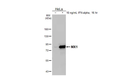 Anti-MX1 antibody [GT4812] used in Western Blot (WB). GTX629738