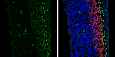 Anti-Vimentin antibody [GT812] used in IHC (Frozen sections) (IHC-Fr). GTX629744