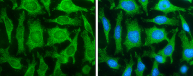 Anti-Fatty Acid Synthase antibody [GT556] used in Immunocytochemistry/ Immunofluorescence (ICC/IF). GTX629762
