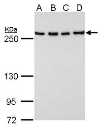 Anti-Fatty Acid Synthase antibody [GT556] used in Western Blot (WB). GTX629762