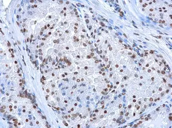 Anti-5-Hydroxymethylcytosine / 5-hmC antibody [GT13612] used in IHC (Paraffin sections) (IHC-P). GTX629765