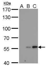 Anti-Carbonic Anhydrase IX antibody [GT546] used in Western Blot (WB). GTX629820