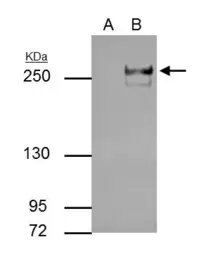 Anti-TET2 antibody [GT411] used in Immunoprecipitation (IP). GTX629879