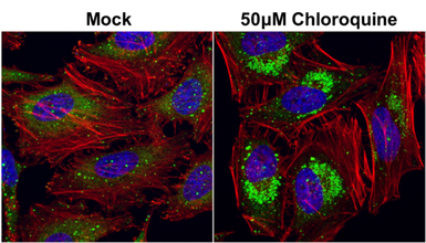 Anti-SQSTM1 / P62 antibody [GT239] used in Immunocytochemistry/ Immunofluorescence (ICC/IF). GTX629888