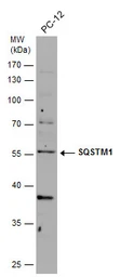 Anti-SQSTM1 / P62 antibody [GT239] used in Western Blot (WB). GTX629888
