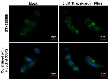 Anti-SQSTM1 / P62 antibody [GT239] used in Immunocytochemistry/ Immunofluorescence (ICC/IF). GTX629888