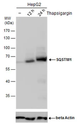 Anti-SQSTM1 / P62 antibody [GT1478] used in Western Blot (WB). GTX629890