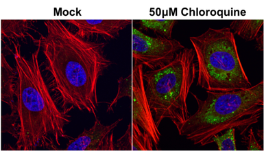 Anti-SQSTM1 / P62 antibody [GT1478] used in Immunocytochemistry/ Immunofluorescence (ICC/IF). GTX629890