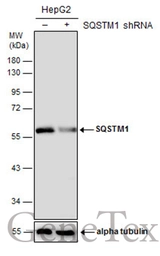 Anti-SQSTM1 / P62 antibody [GT1478] used in Western Blot (WB). GTX629890