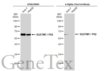 Anti-SQSTM1 / P62 antibody [GT1478] used in Western Blot (WB). GTX629890