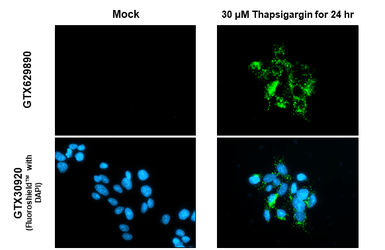 Anti-SQSTM1 / P62 antibody [GT1478] used in Immunocytochemistry/ Immunofluorescence (ICC/IF). GTX629890