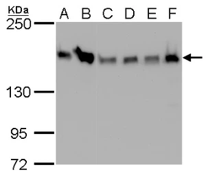 Anti-ROCK1 + ROCK2 antibody [GT261] used in Western Blot (WB). GTX629971
