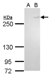 Anti-TET1 antibody [GT465] used in Western Blot (WB). GTX629974