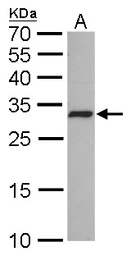 Anti-CDK4 antibody [GT624] used in Western Blot (WB). GTX629975