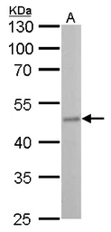 Anti-Fumarate hydratase antibody [GT548] used in Western Blot (WB). GTX630145