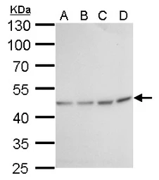 Anti-Fumarate hydratase antibody [GT7612] used in Western Blot (WB). GTX630146