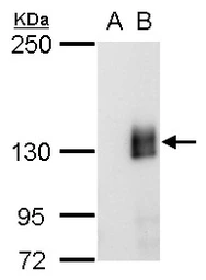 Anti-mCherry antibody [GT857] used in Western Blot (WB). GTX630189