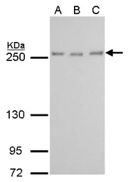 Anti-mTOR antibody [GT6611] used in Western Blot (WB). GTX630199