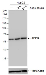Anti-NDP52 antibody [GT1813] used in Western Blot (WB). GTX630397