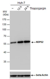 Anti-NDP52 antibody [GT1813] used in Western Blot (WB). GTX630397